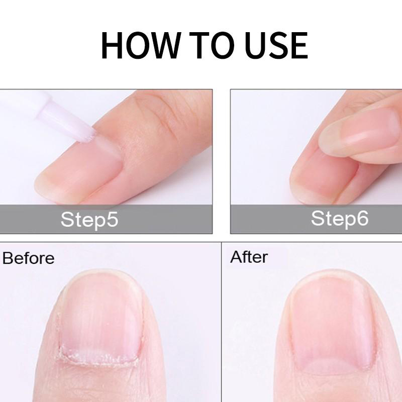 Professionele korte nagelriems - Tech Accessories Products recensie en prijs